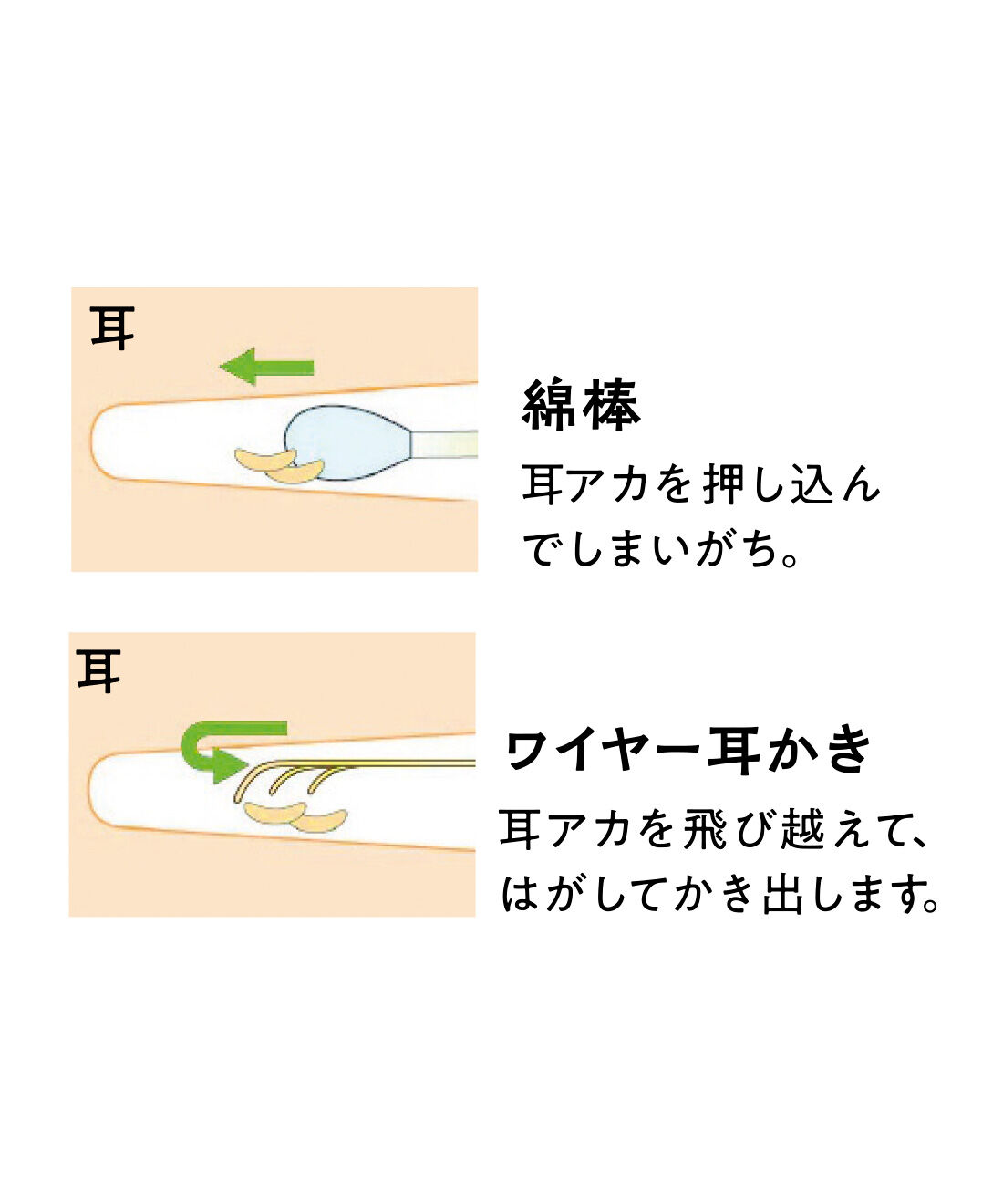 FELISSIMO PARTNERS|ののじ 3連ループでしっかりキャッチ 爽快ワイヤー耳かき