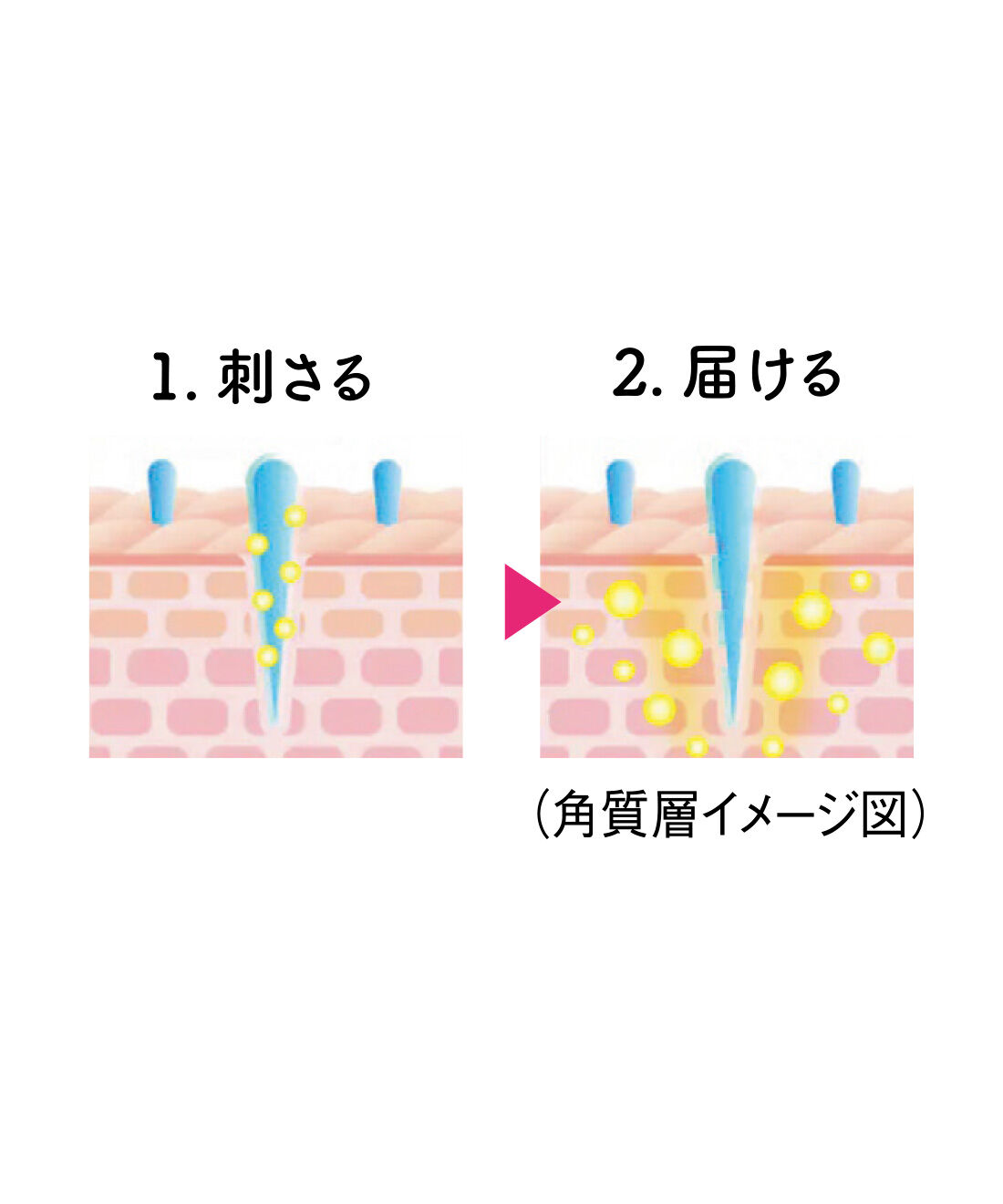flufeel|天然の美容針！ ※1 美容液成分を角質層まで届ける 1枚4役のオールインワンフェイスマスクの会