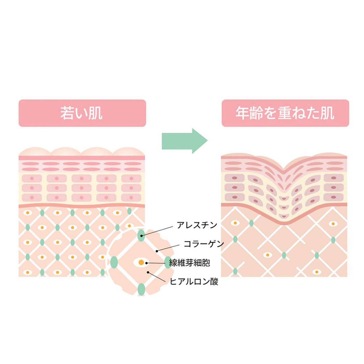 フェリシモの雑貨 Kraso|ＭＥＤＩＨＥＡＬ　フィトレチノールクリームの会|年々肌のハリが減少する様子