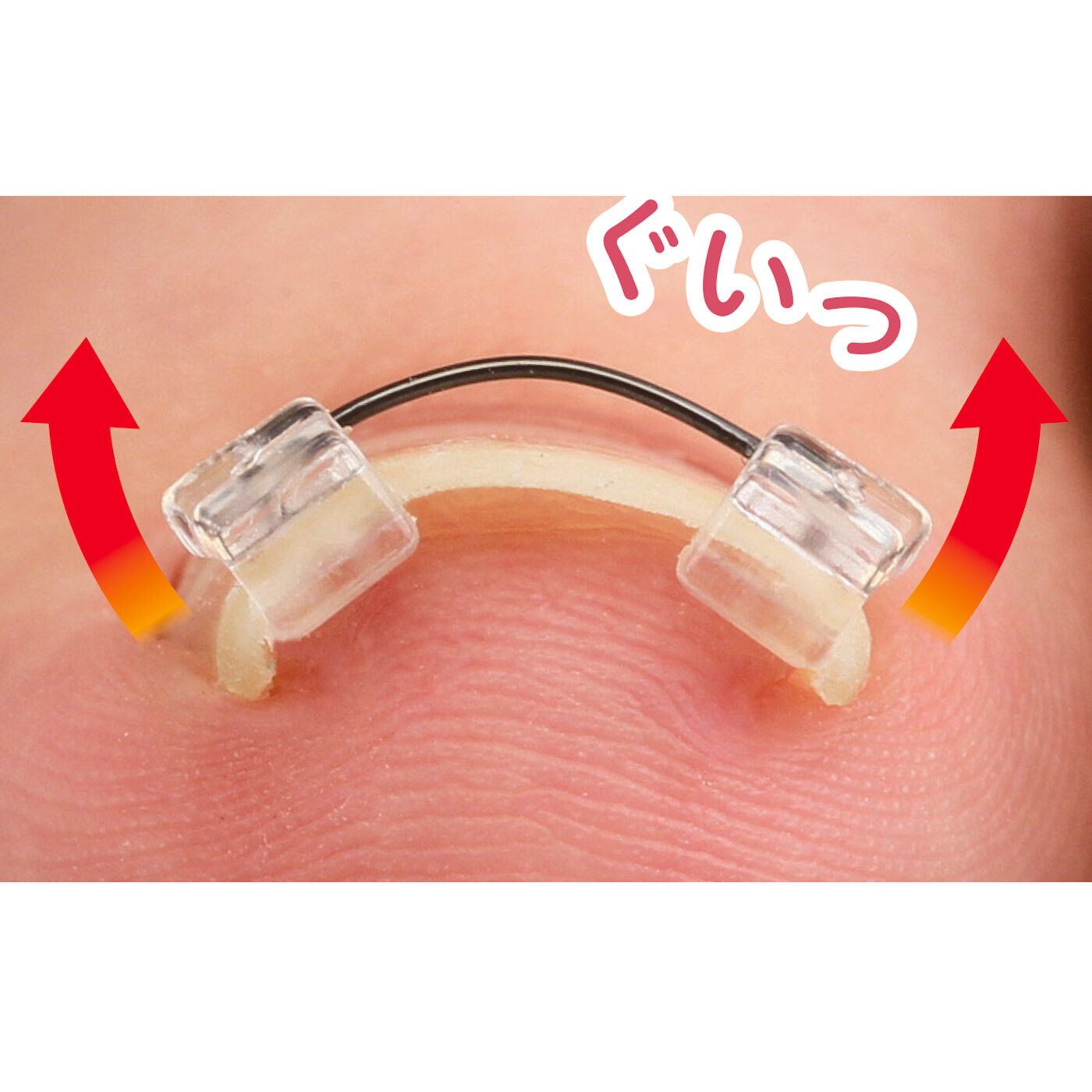 一般医療機器 ひっかけるだけ簡単引き上げ 痛みを緩和する 巻きづめワイヤーガードの会【送料: 450円+税】